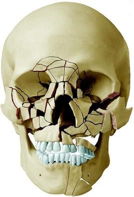 Emergency Facial Trauma Care