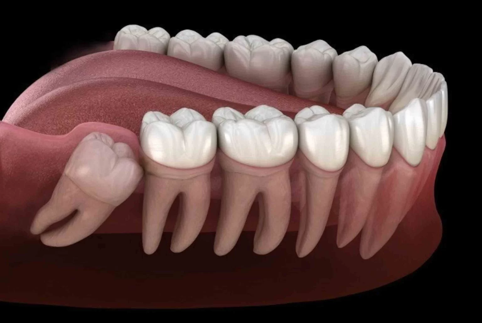 Minor Oral Surgery Clinic